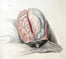 "Charles Bell Anatomy of the Brain, c. 1802" (Wikimedia Commons, Shaheen Lakhan) "Charles Bell Anatomy of the Brain, c. 1802" (Wikimedia Commons, Shaheen Lakhan)