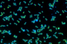 Green rhodopsin proteins inside the blue cell walls help these yeast grow faster when exposed to light. Photo: Anthony Burnetti, Georgia Institute of Technology. Green rhodopsin proteins inside the blue cell walls help these yeast grow faster when exposed to light. Photo: Anthony Burnetti, Georgia Institute of Technology.