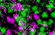 Pseudomonas aeruginosa Pseudomonas aeruginosa